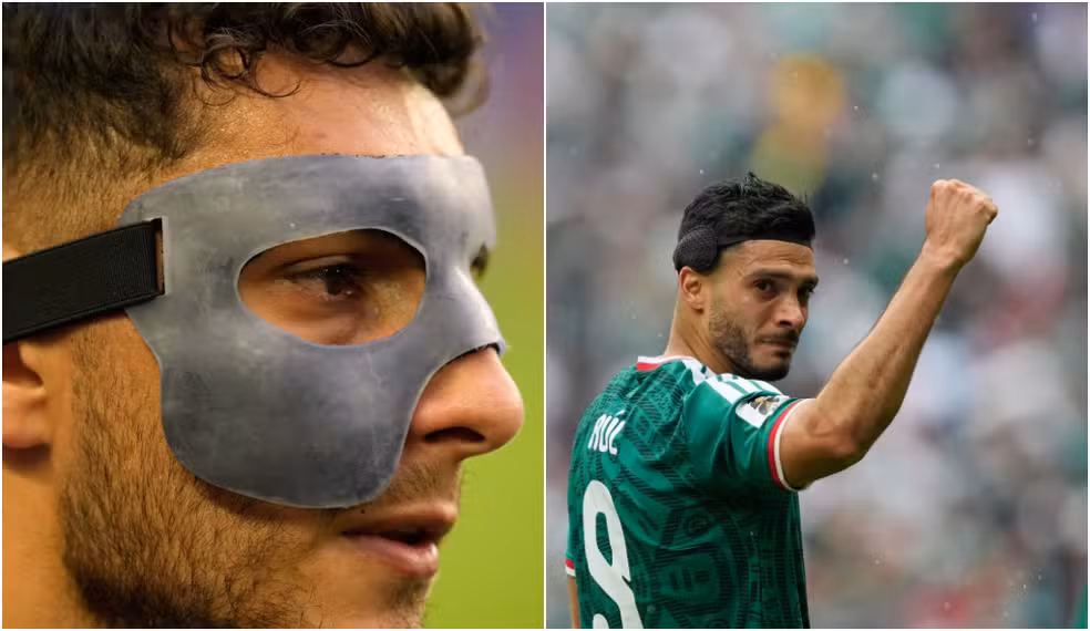 Saiba por que Cáceres usa máscara e Jiménez faixa protetora na Copa