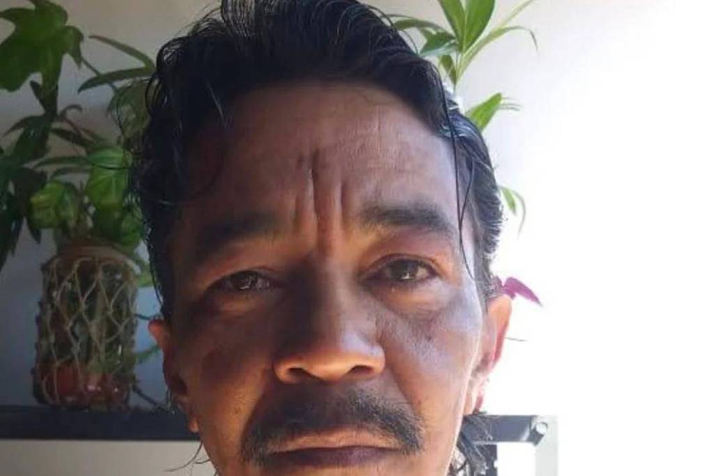 Morre sobrevivente do acidente com césio-137 em Goiás após décadas
