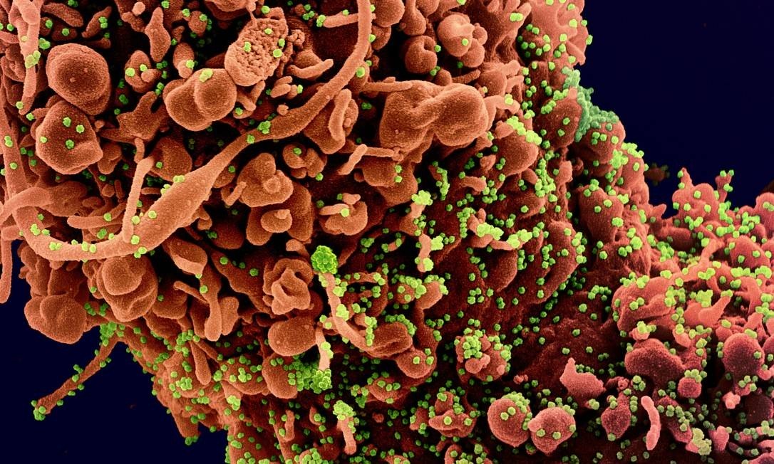 Terapia de anticorpos contra Covid-19 inicia testes entre junho e setembro