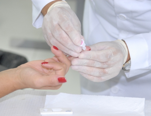 Infectologista do HM explica relação da Covid-19 em pacientes soropositivos