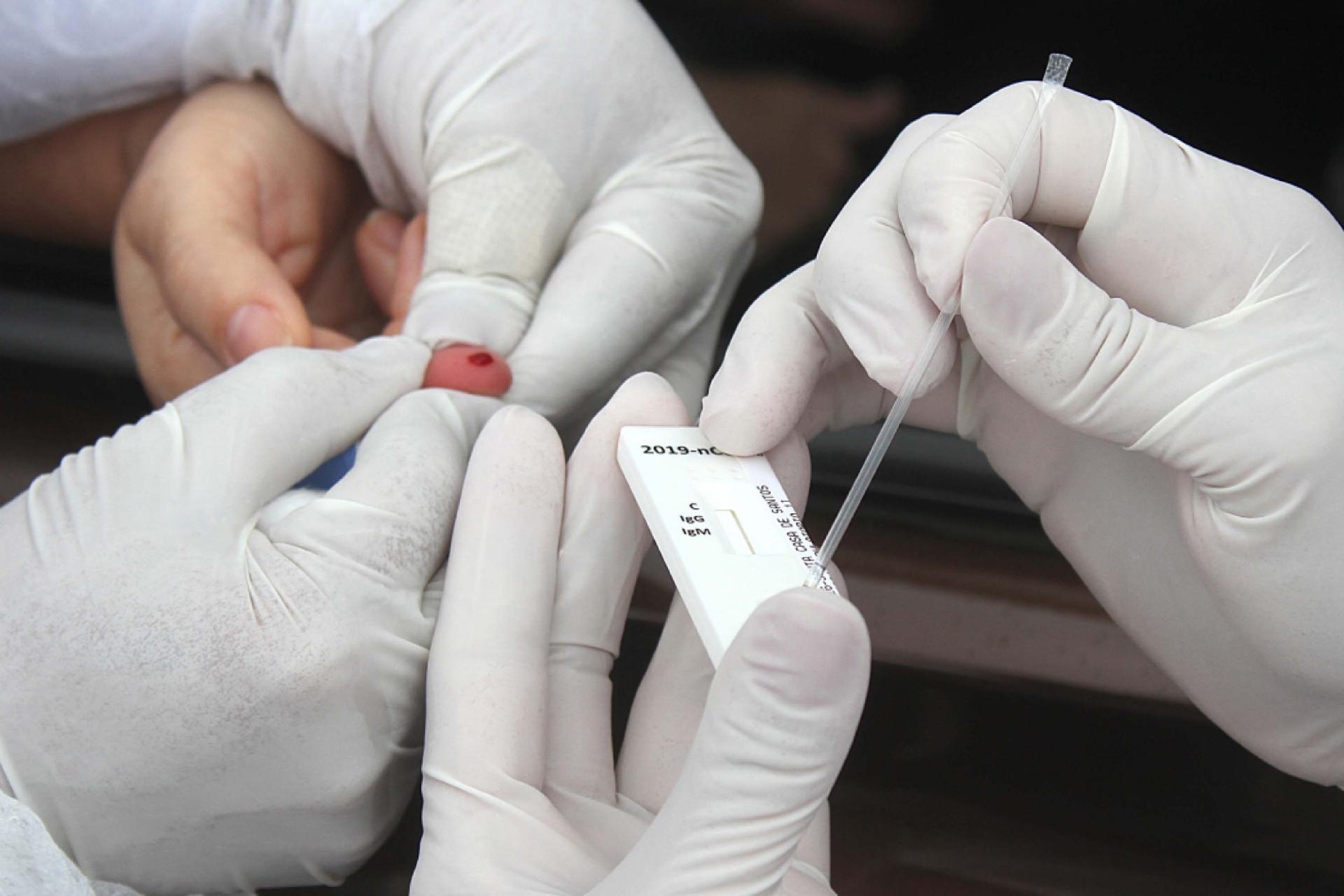 Após recomendação do MPE e DPE, Unimed passa a realizar testes de Covid-19