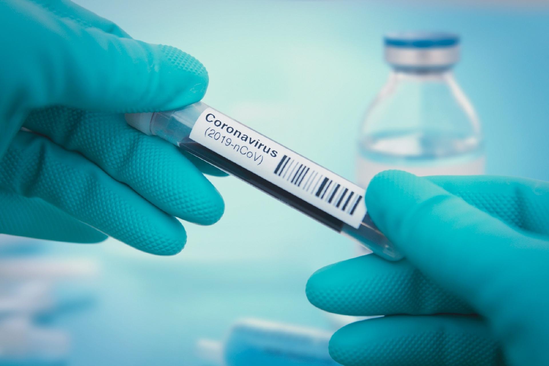 Alagoas tem no total 50.951 casos confirmados da covid-19