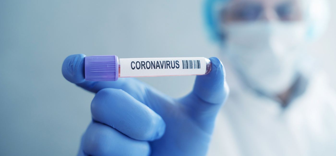 Alagoas passa de 74 mil casos confirmados da covid-19