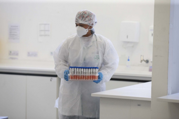 Cientistas em Hong Kong confirmam caso de reinfecção pelo coronavírus