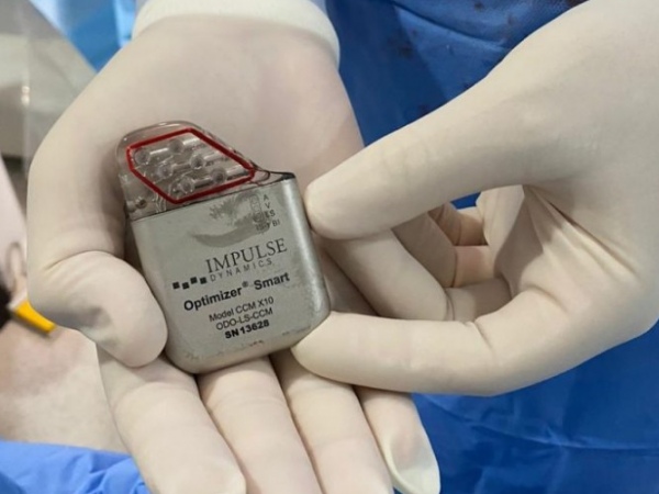 Modulador de contração cardíaca chega à Santa Casa de Maceió