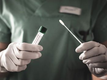 Média móvel de mortes por Covid-19 atinge alta de 116% em Alagoas