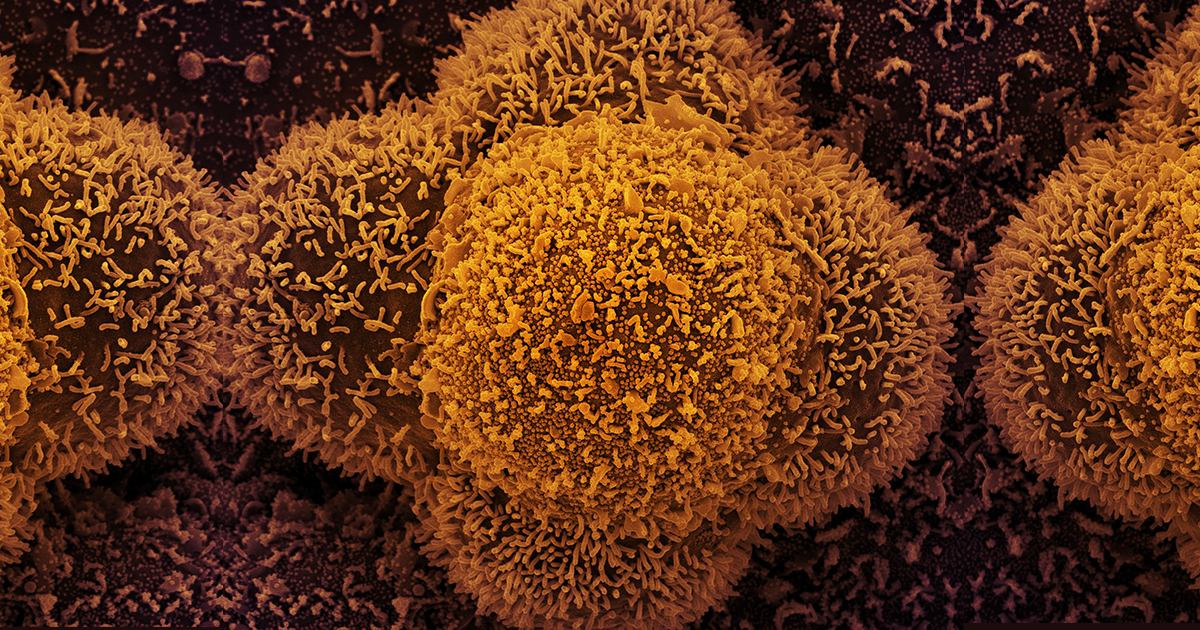 Alagoas registra 650 casos de Covid-19 em um dia