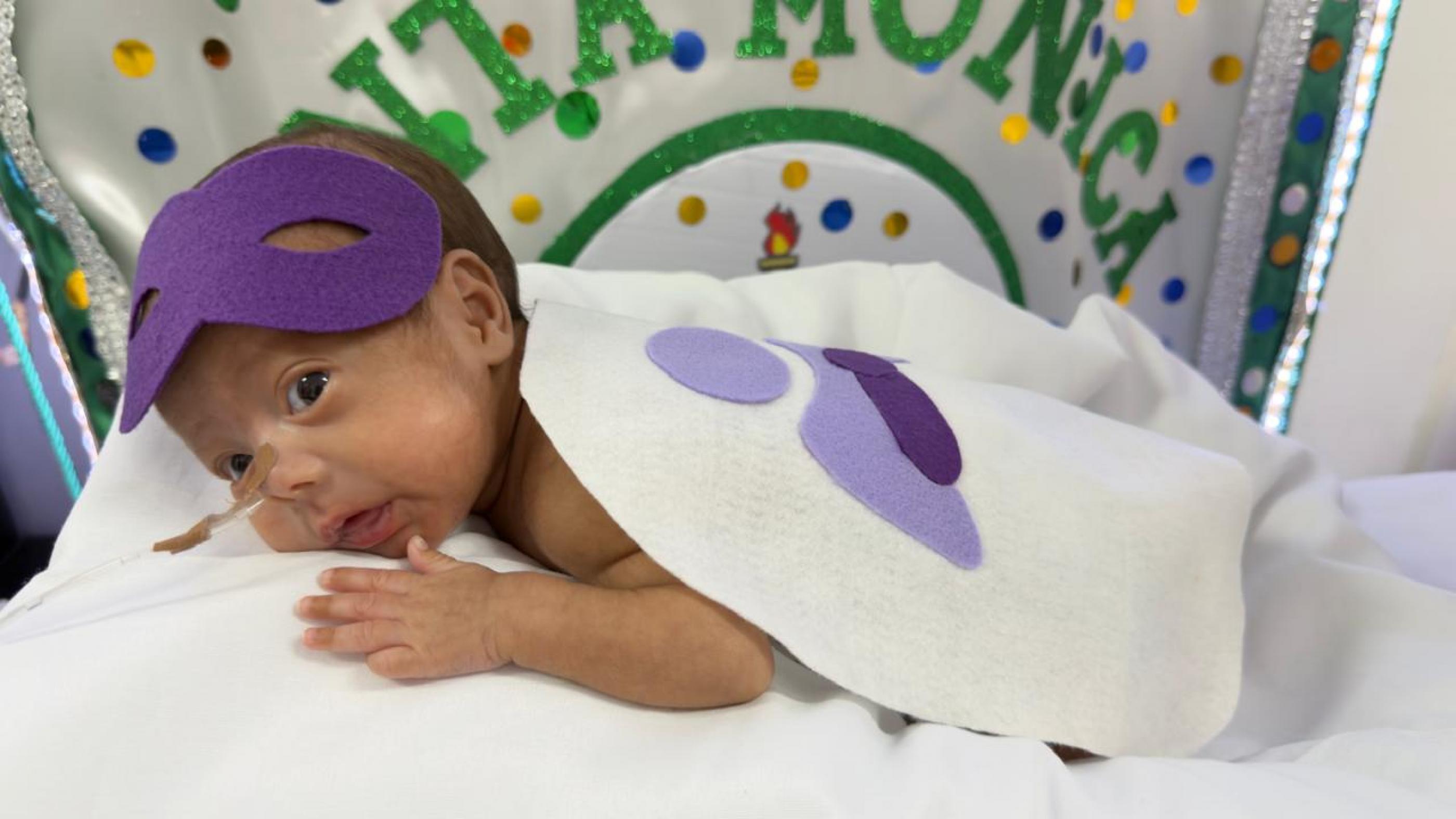 Maternidade Santa Mônica realiza fotos de Carnaval com bebês prematuros