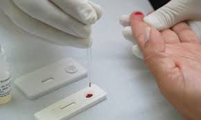 Teste rápido para HIV será promovido pela Sesau neste sábado (28) em AL