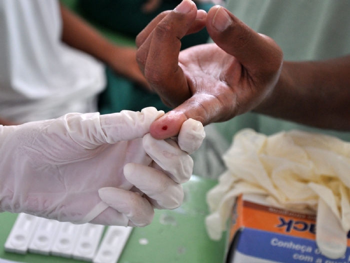Alagoas deve realizar exames em paciente com hepatite B