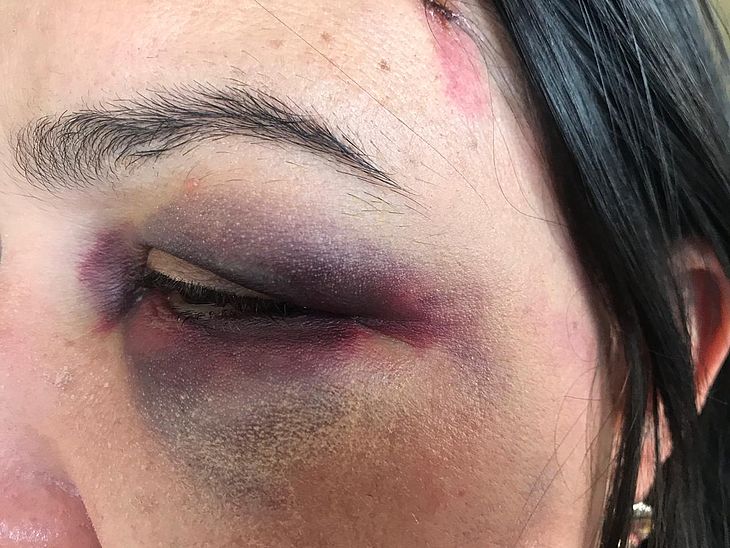 Mulher denuncia agressão por eleitores de Bolsonaro