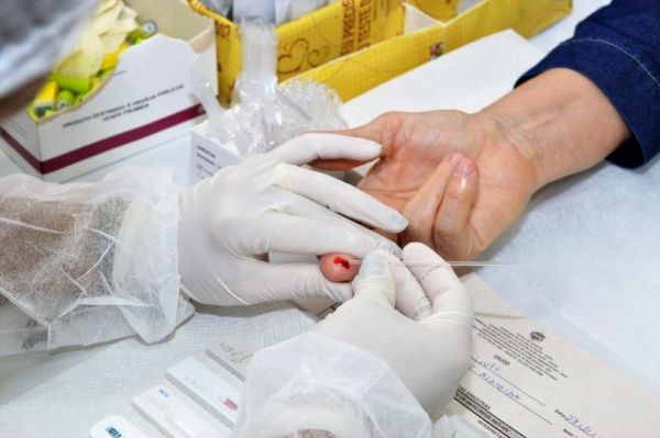 Em 32 anos, Estado de Alagoas registra mais de 6.800 casos diagnosticados de Aids