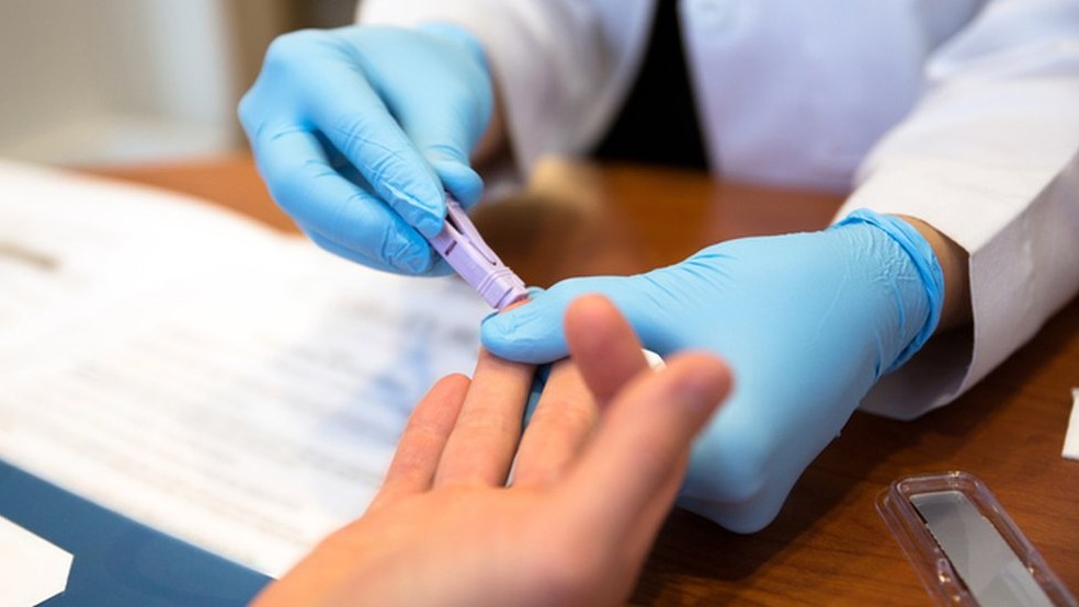 Dezembro Vermelho: Hospital Helvio Auto oferece testes de HIV nesta sexta-feira (6)