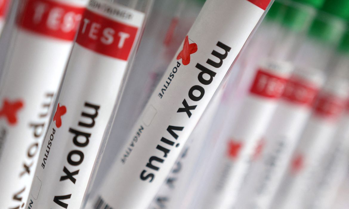 Casos confirmados de Mpox chegam a 140 no Brasil em 2026