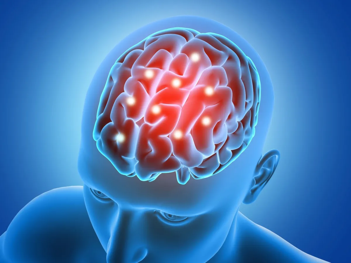 Marcapasso cerebral ajuda no tratamento do Parkinson e do TOC grave