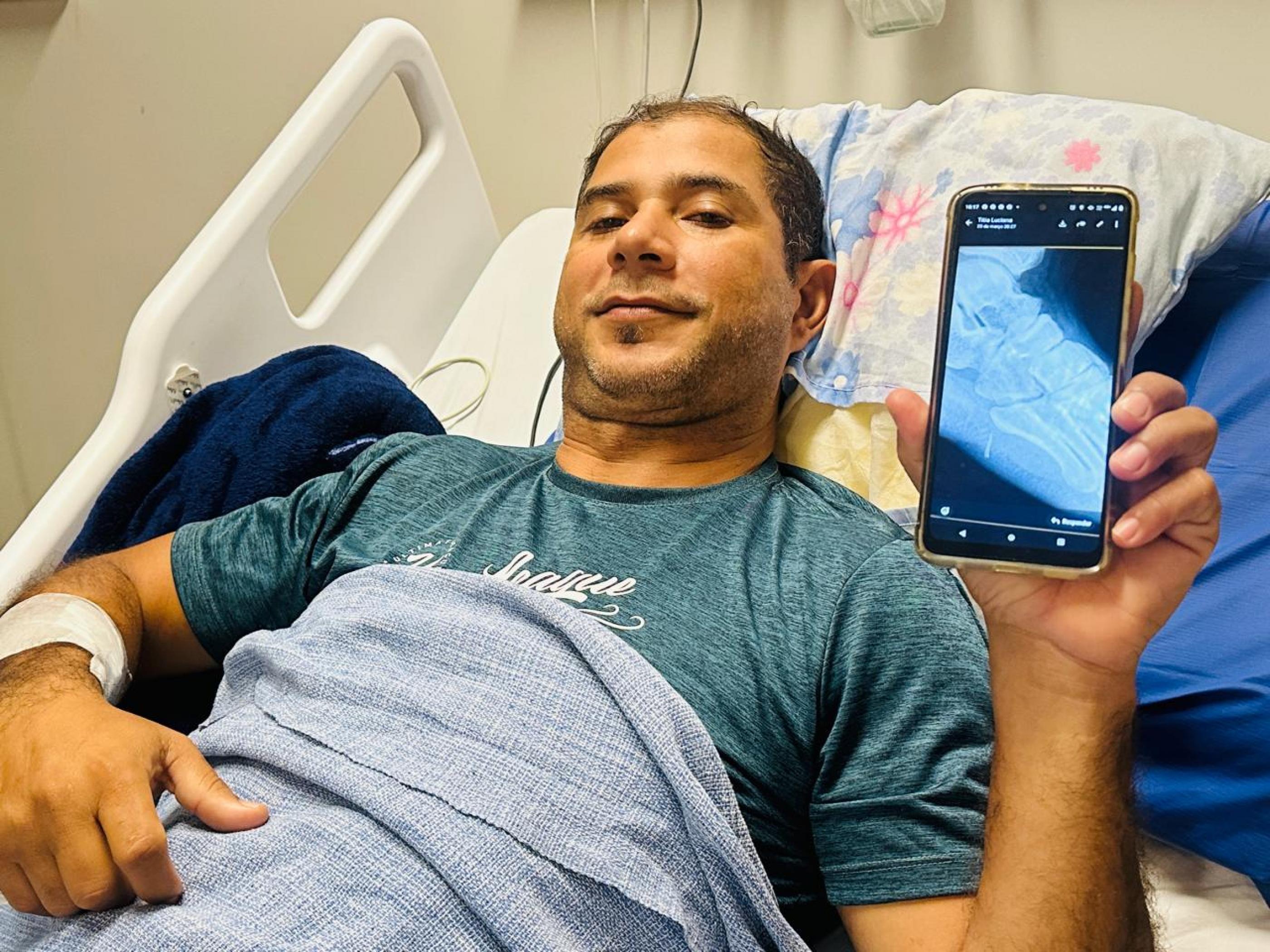 Homem passa por cirurgia após acidente com ferrão de peixe em Ipioca