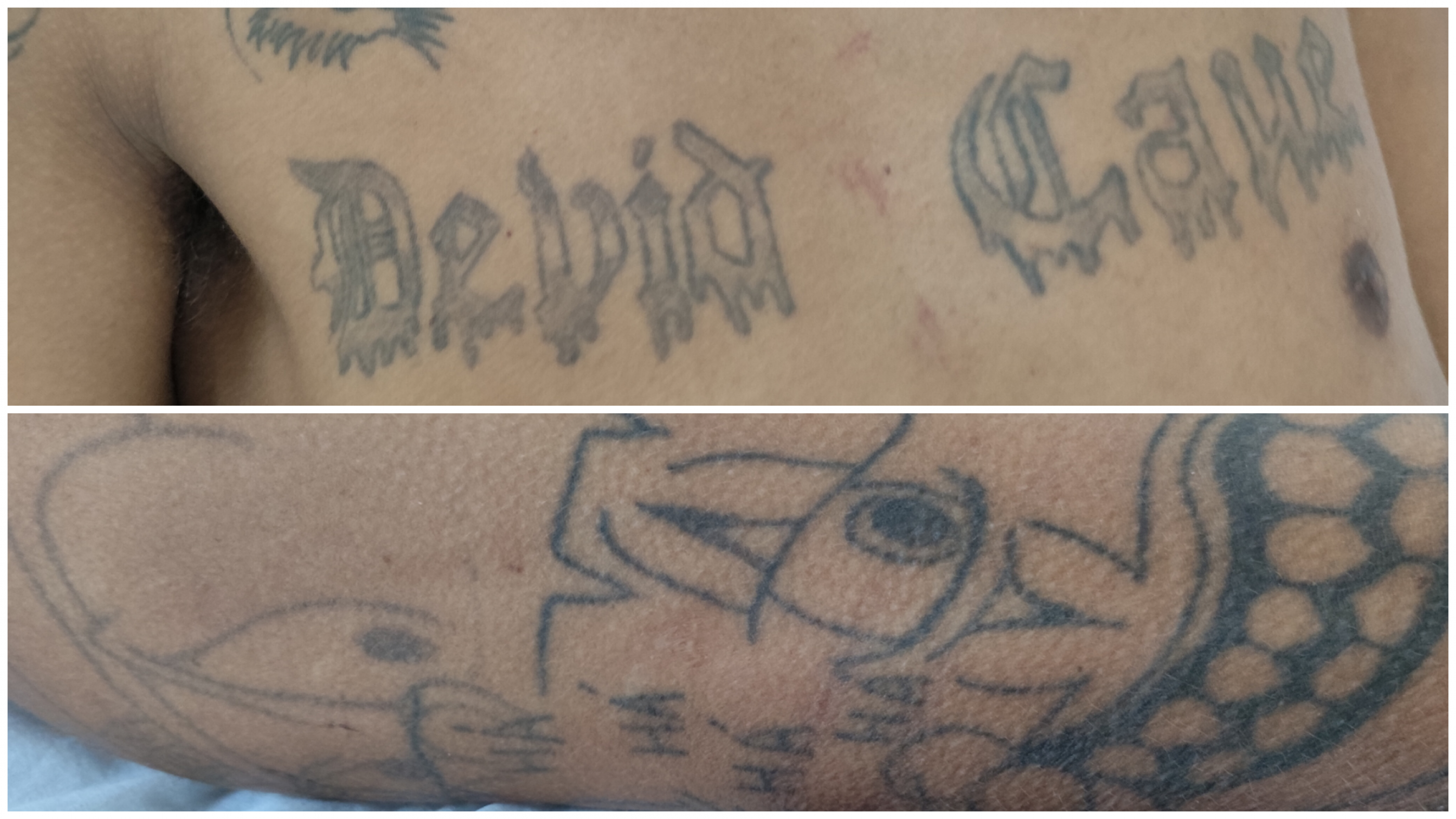 Vítima de agressão procura por familiares em Arapiraca