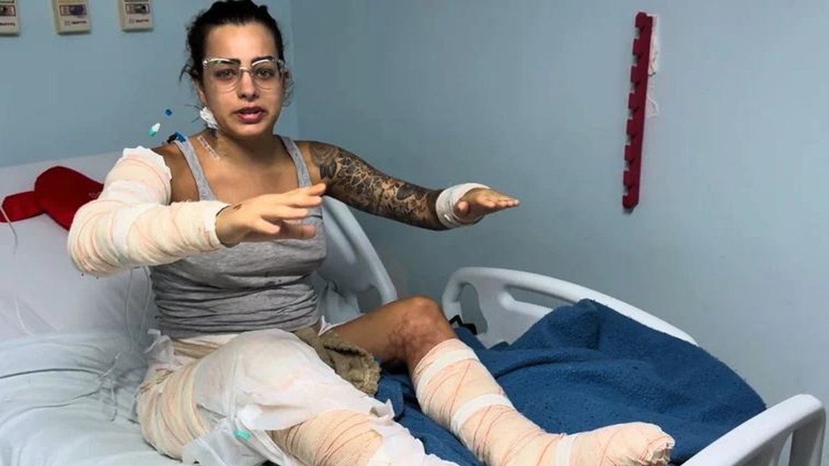 “Não morri porque ele me salvou”, diz mulher após incêndio em kitnet em Maceió