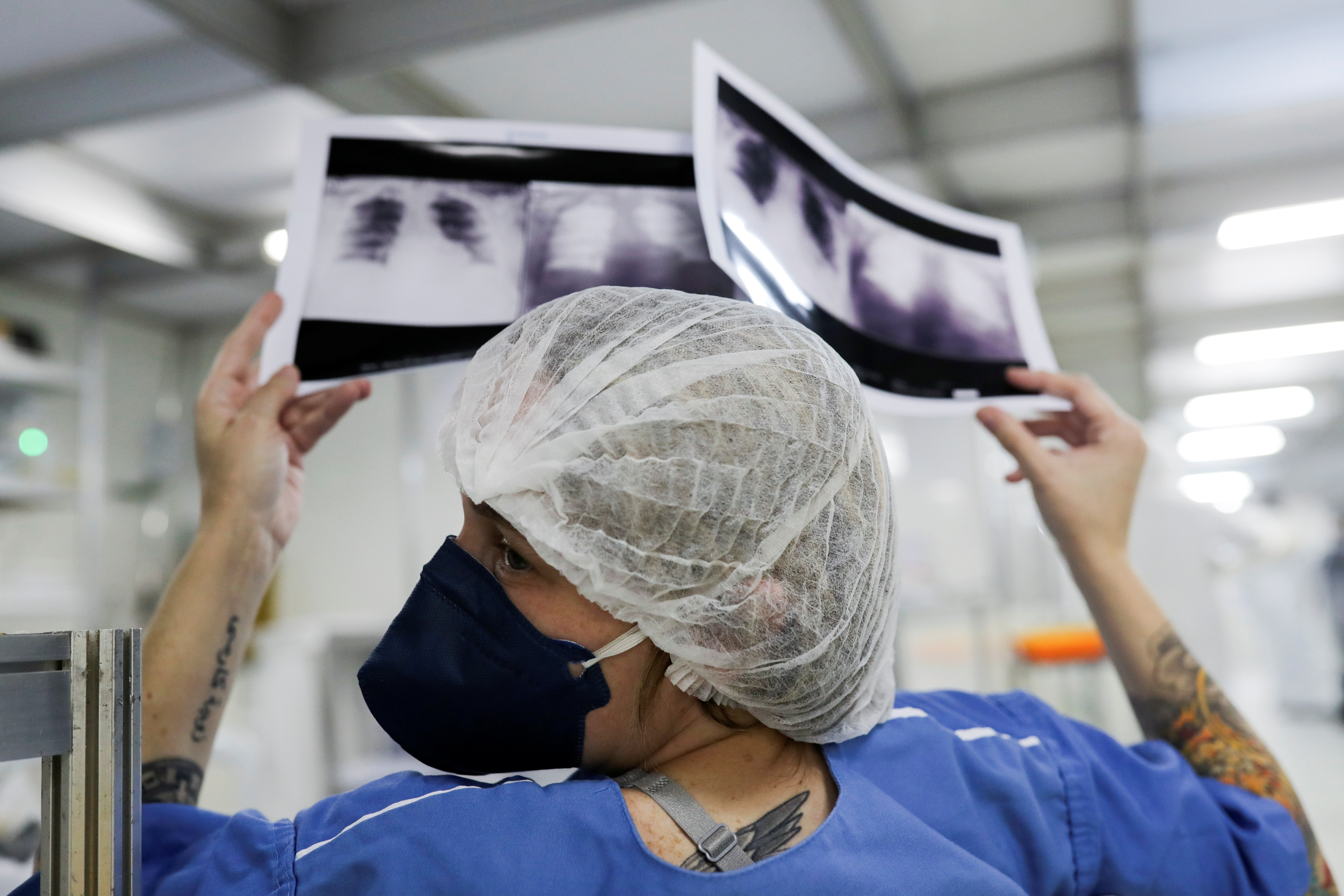 Diagnóstico tardio reduz chances de cura do câncer de pulmão