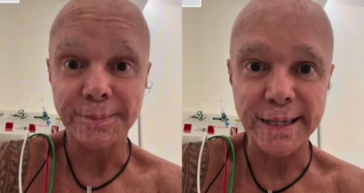 Netinho se afasta das redes sociais durante tratamento contra linfoma