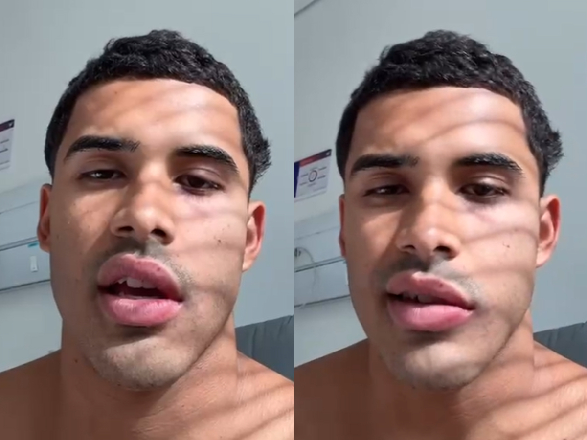 Cantor Nilo pausa carreira após diagnóstico de paralisia de Bell