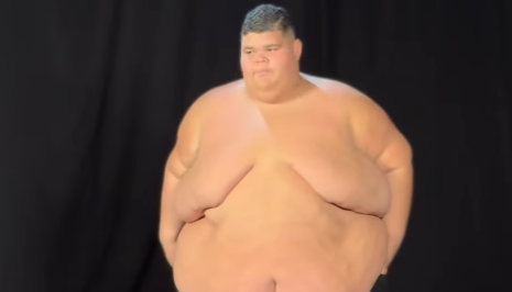 Gordão da XJ mostra antes e depois após perder 130 kg