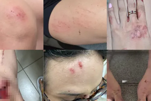 Justiça nega prisão de acusado de agredir influenciadora em Maceió