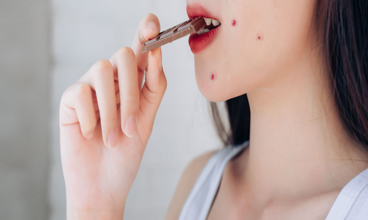 Chocolate causa espinha? Especialistas explicam relação entre dieta e acne