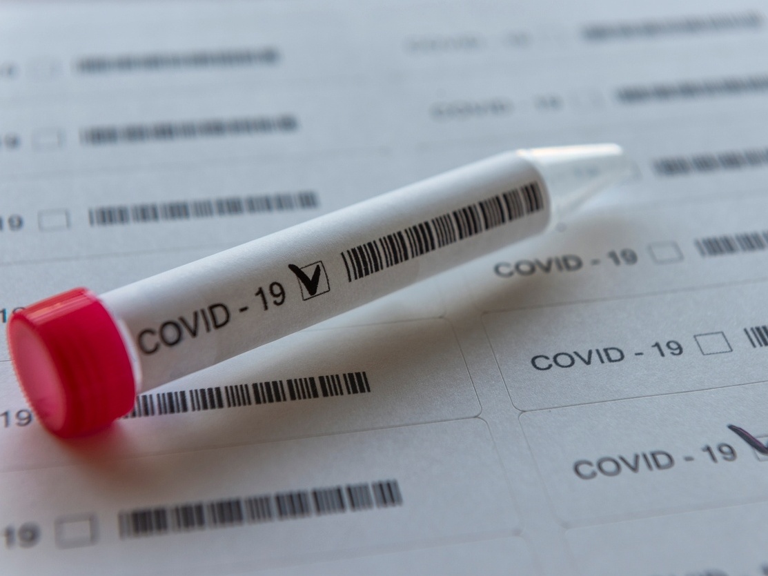 Jovem puérpera de 28 anos é uma das duas vítimas do Covid-19 nesta terça (21)