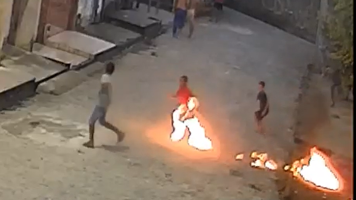 Menino de 7 anos sofre queimaduras graves nas pernas após acidente com fogos em Rio Largo