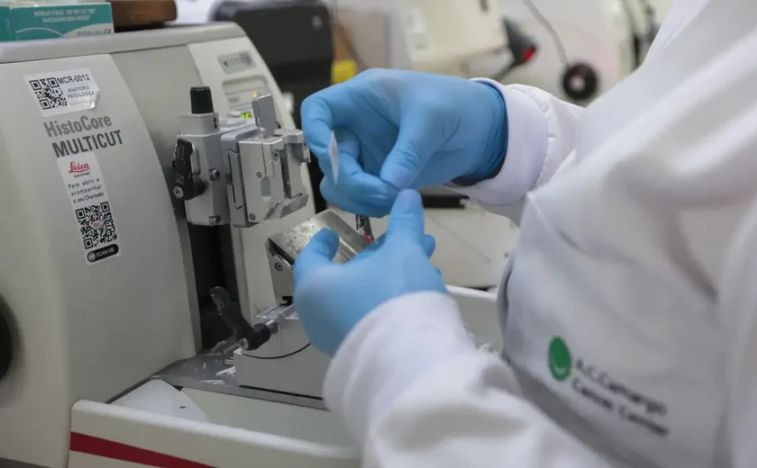 Cura do câncer de próstata pode alcançar 98%, aponta especialista da Sociedade Brasileira de Urologia