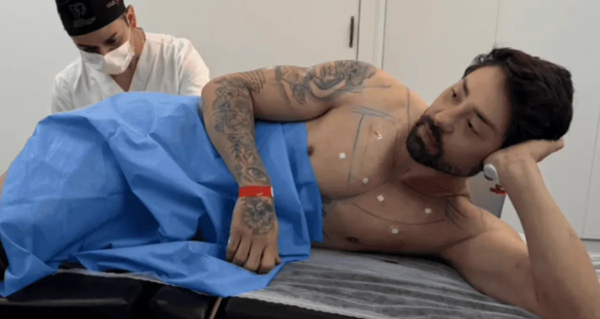 Rico Melquiades revela “cutox” e médico alerta sobre uso da toxina