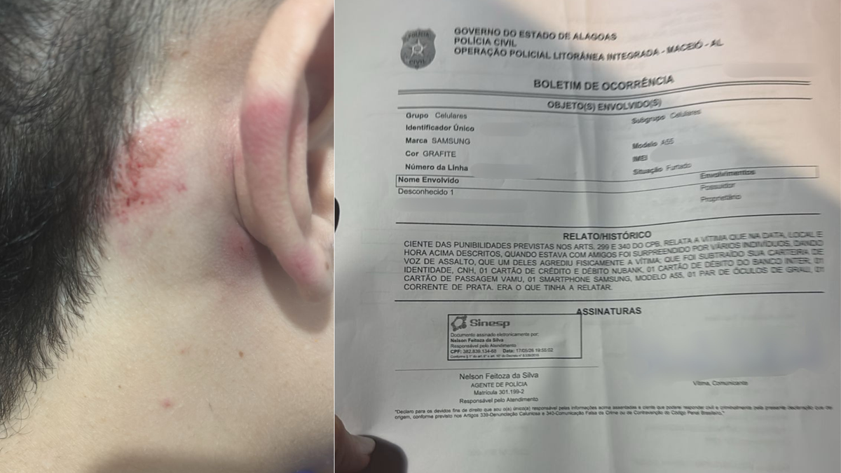 Casal de amigos é roubado e agredido durante arrastão na praia Ponta Verde