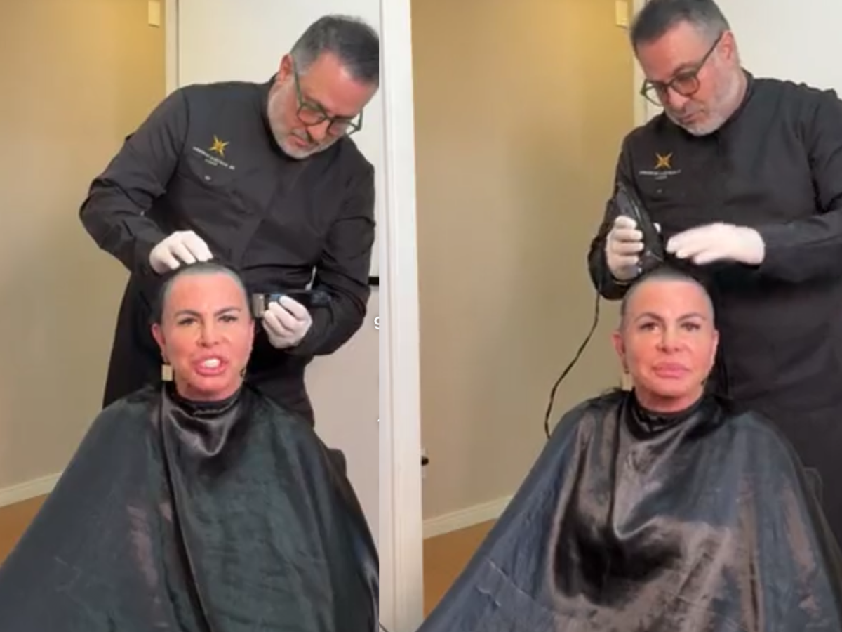 Gretchen raspa cabelo ao vivo antes de transplante capilar contra alopecia