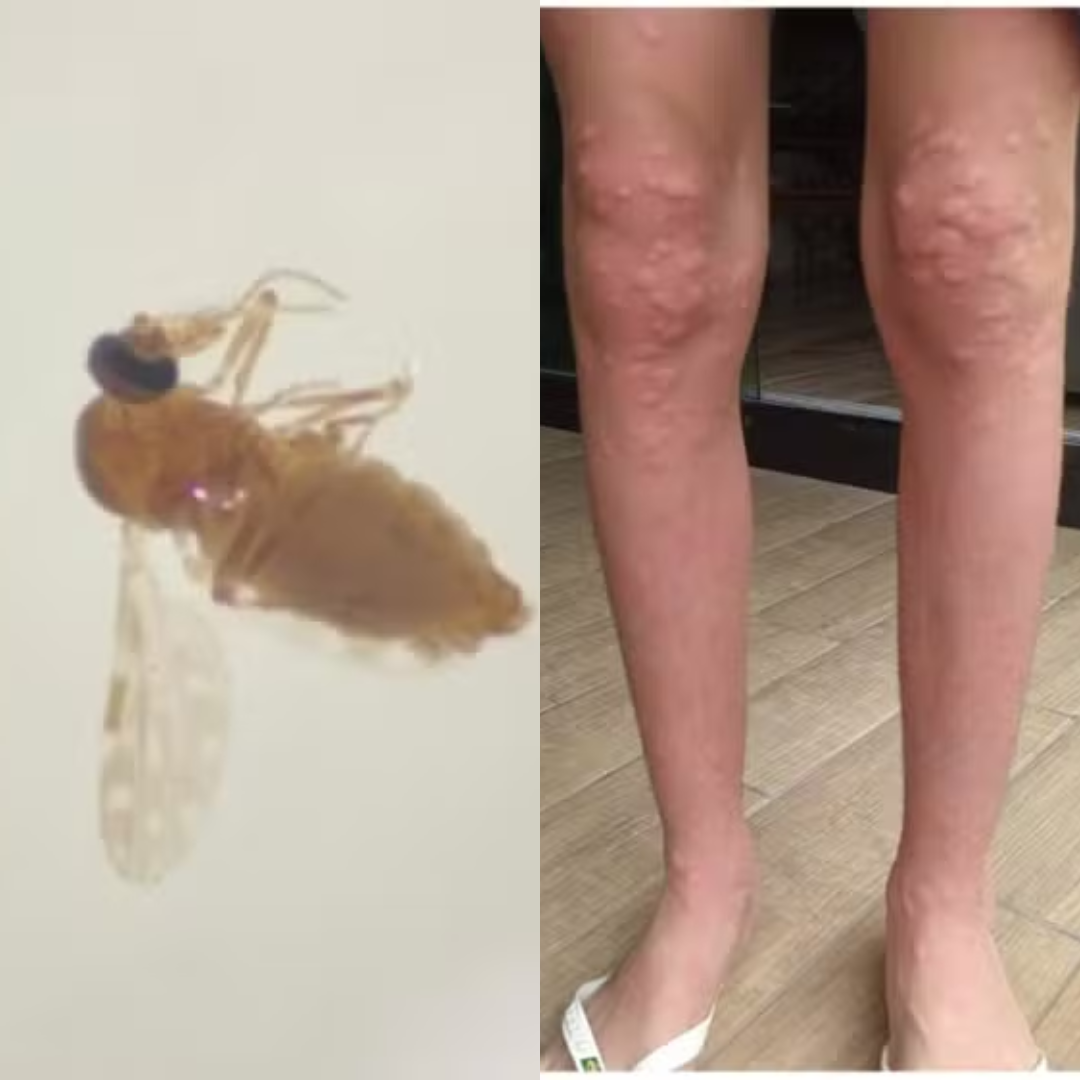 Conheça o mosquito que fez moradores em SC se 'trancarem' em casa