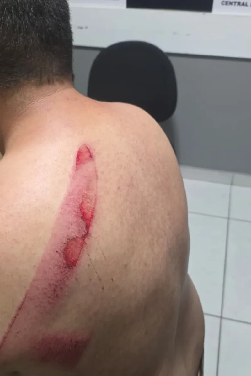 Jovem é ferido a facão durante comemoração da vitória de Lula em Maceió