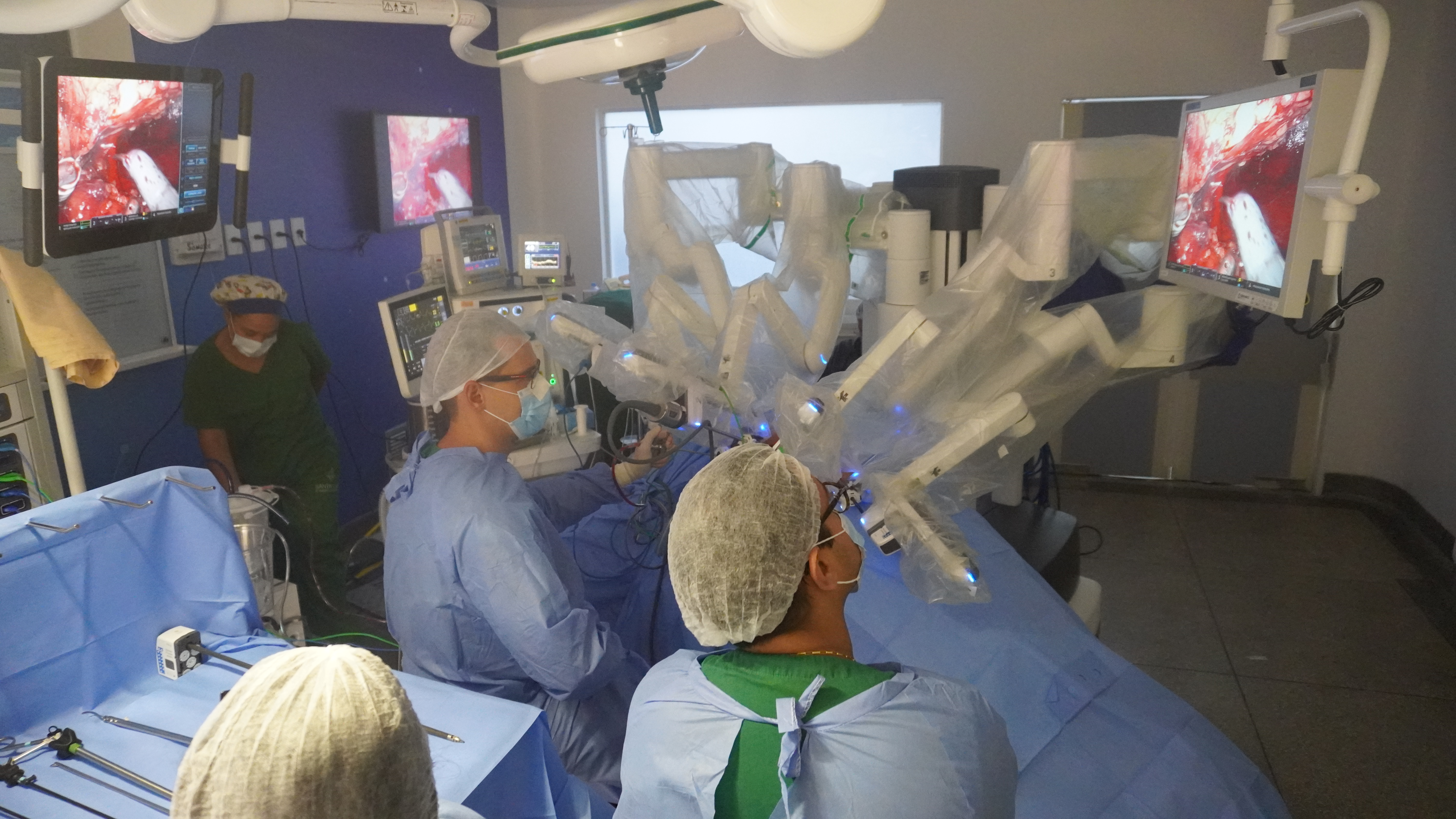 Cirurgia robótica alia tecnologia e saúde na Santa Casa de Maceió