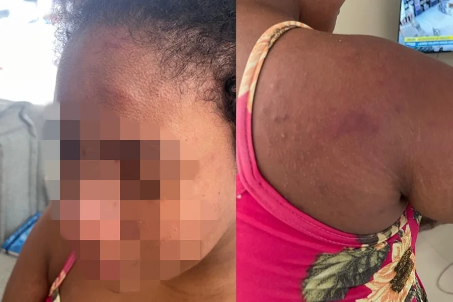 Caso de tortura contra doméstica grávida choca o Maranhão