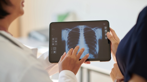 Anvisa aprova medicamento para hipertensão pulmonar