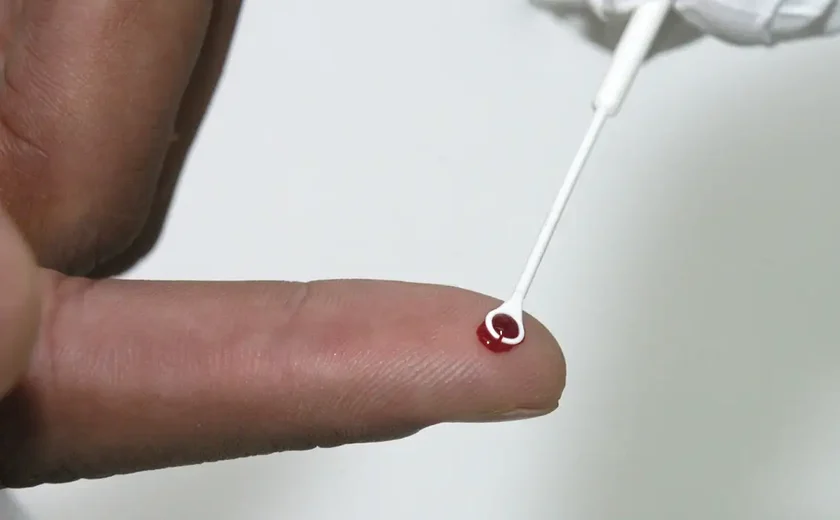 Fiji declara emergência nacional após disparada de casos de HIV
