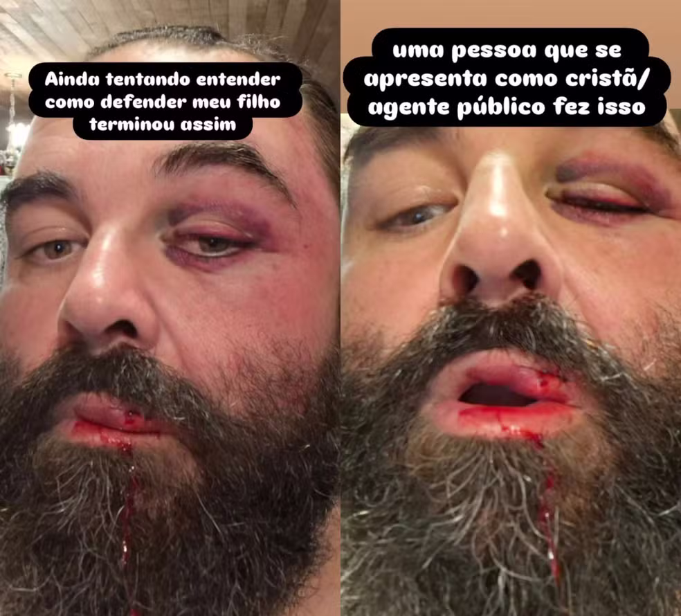 Pai de autista denuncia agressão após reclamar de som alto a fiéis de igreja evangélica