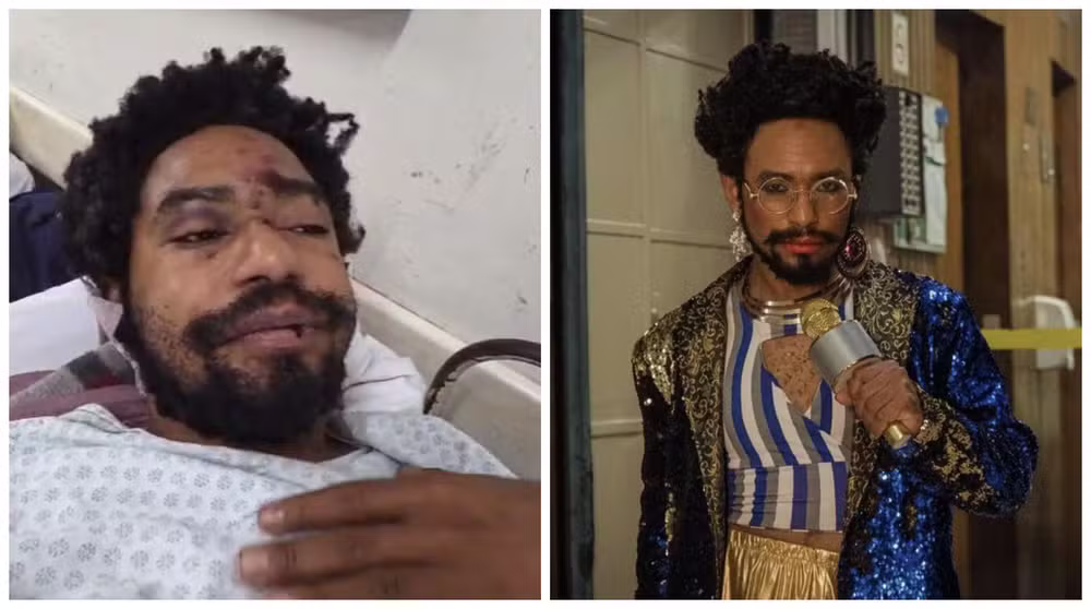 Polícia de São Paulo investiga ataque homofóbico contra o ator Diego Summer