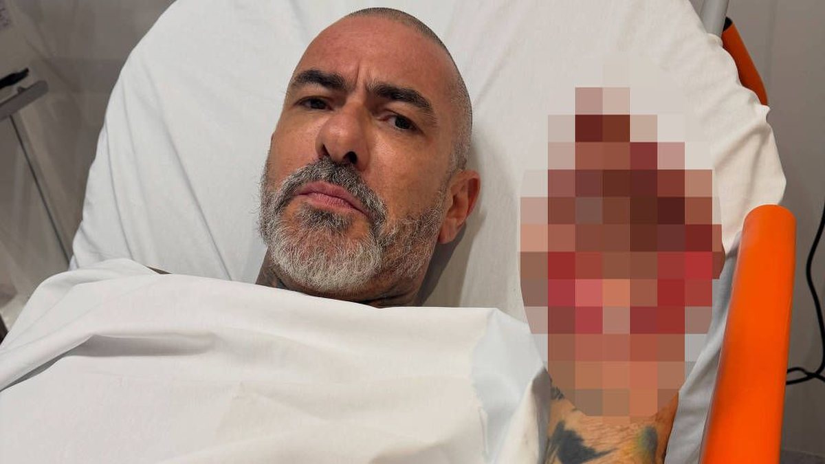 Fogaça revela que quase morreu em acidente de moto: 'Peguei óleo na pista'