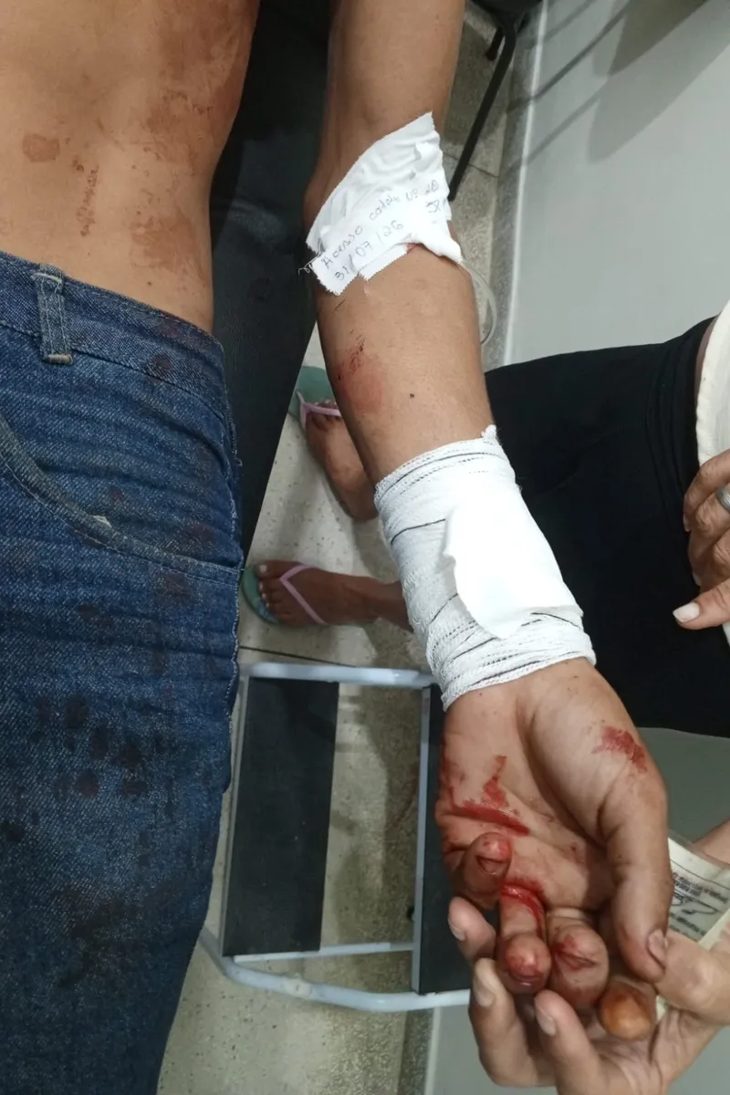Em AL, homem é esfaqueado no peito e suspeito é detido pela Guarda Municipal
