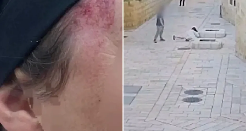 Homem é preso após agredir freira católica de 48 anos em Jerusalém