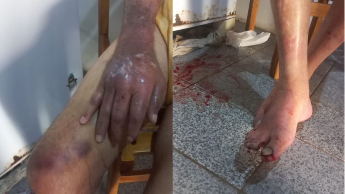 Filha é presa por maus-tratos após idoso de 84 anos ser encontrado com várias lesões