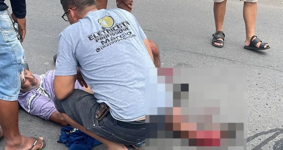 Idoso tem perna esmagada após colisão com ônibus na AL-110 em Arapiraca