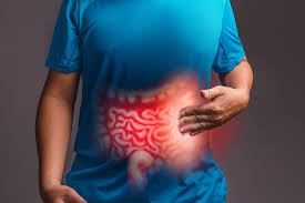 Os cuidados necessários para evitar doenças inflamatórias intestinais