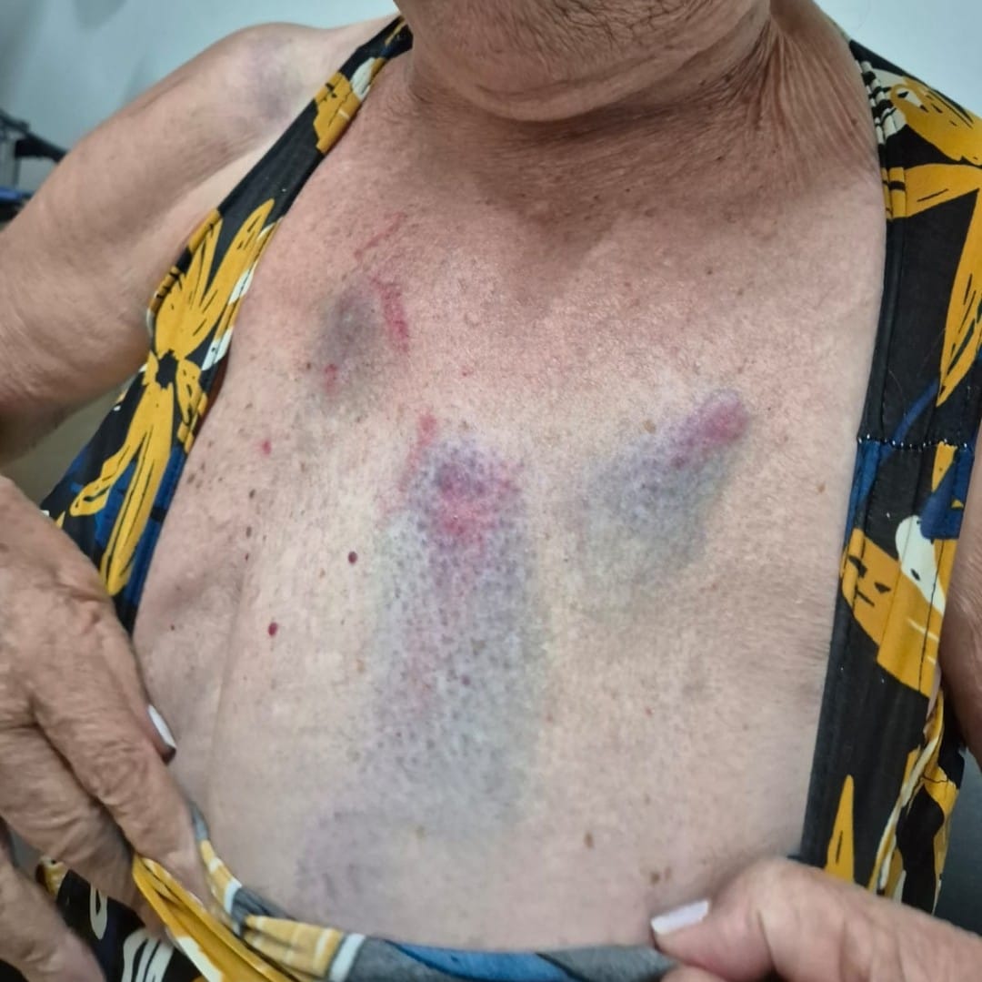 Médica é presa novamente por agredir tia idosa em Arapiraca