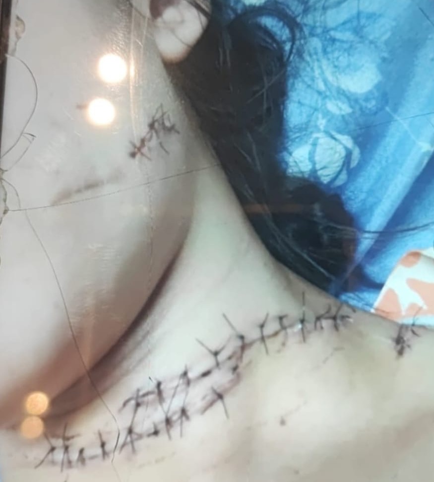 Homem é preso em Maceió após ataque contra ex-companheira